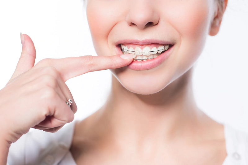 "Braces and Aligners Treatment at Dr. JJ Multispeciality Clinic, Bhopal"