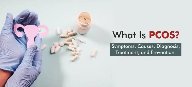 "PCOS Symptoms, Causes, Diagnosis, Treatment, and Prevention at Dr. JJ Multispeciality Clinic, Bhopal"
